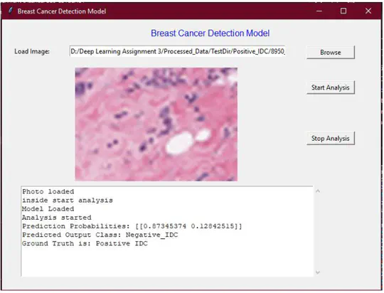 Breast Cancer Classification